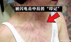僵尸猪人要被移除了